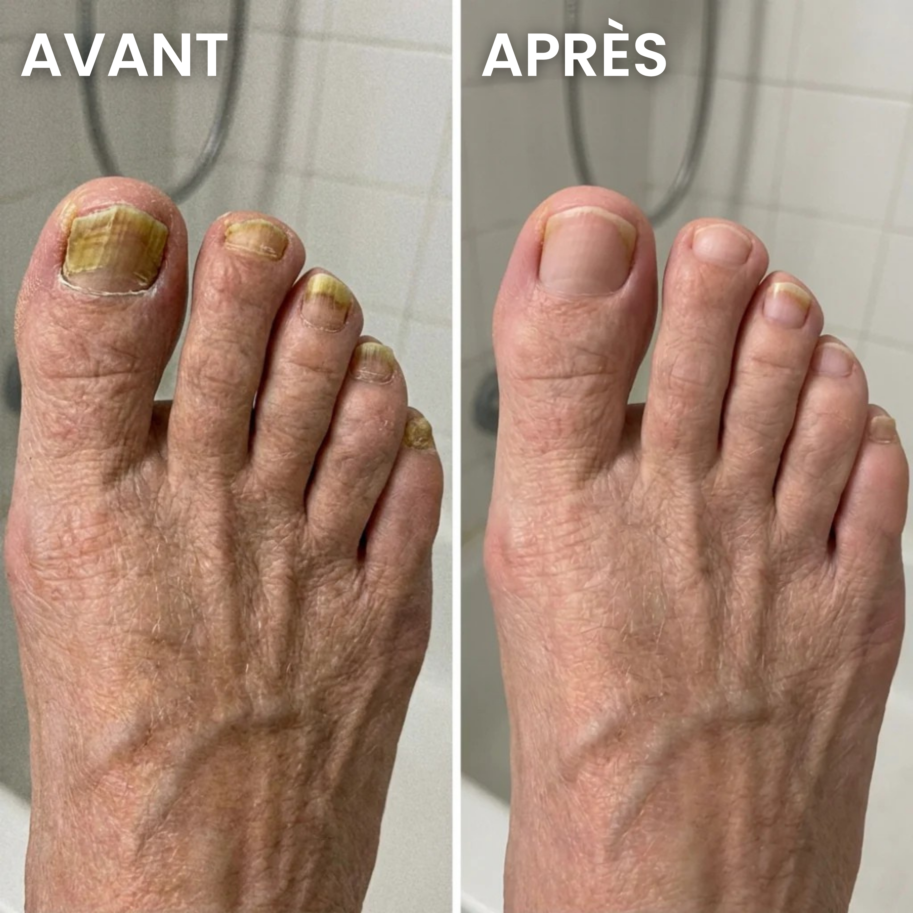 Stylo soin des ongles