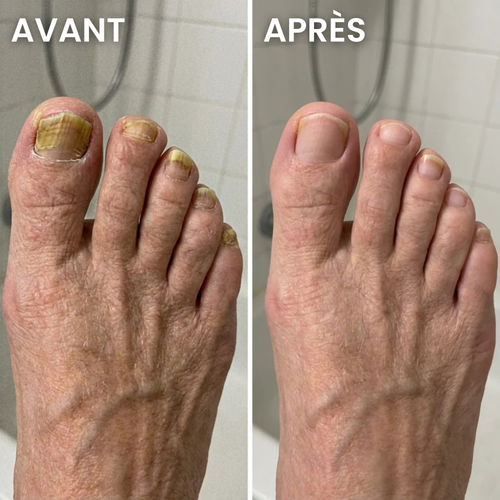 Stylo soin des ongles